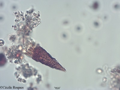 protozoo/Cyrtostrombidium longisomum (1)(copy)_thumb.jpg